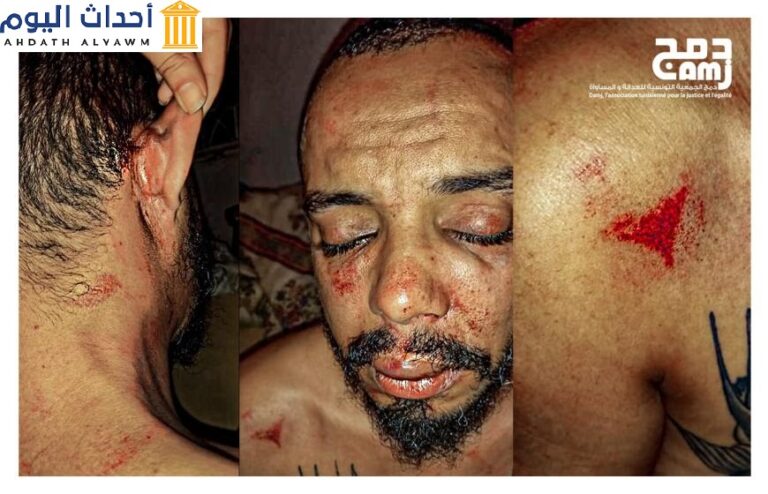 "بدر بعبو"، مدير جمعية "دمج" (الجمعية التونسية للعدالة والمساواة)