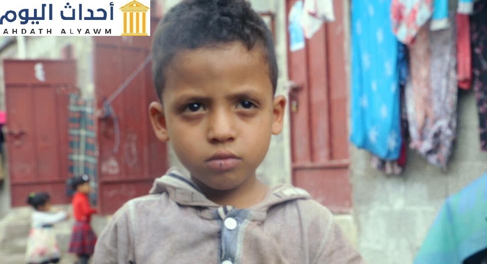 عبد الله يعيش في مخيم للنازحين منذ أن كان في الخامسة من عمره. ضاعت طفولته وهو في المخيم .. هذه الصورة لعبدالله وهو في الخامسة من عمره عام 2016