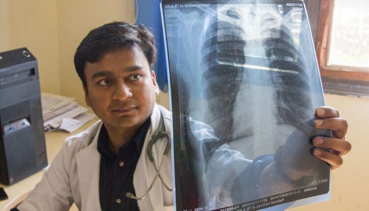 طبيب في الهند يقوم بفحص الأشعة السينية لمريض بحثا عن أي تلف في الرئة، قد يشير إلى مرض السل