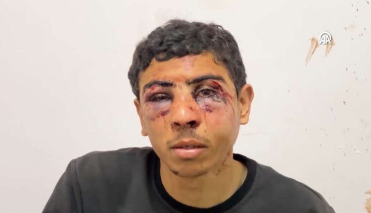 توثيق حقوقي لتنكيل وتعذيب الجيش الإسرائيلي فلسطينيين في غزة