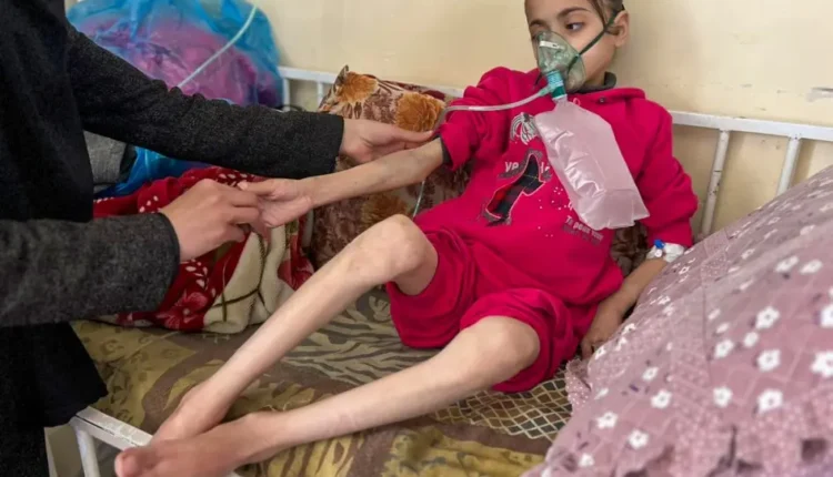 هيومن رايتس ووتش: التجويع الذي تفرضه إسرائيل يقتل الأطفال في غزة