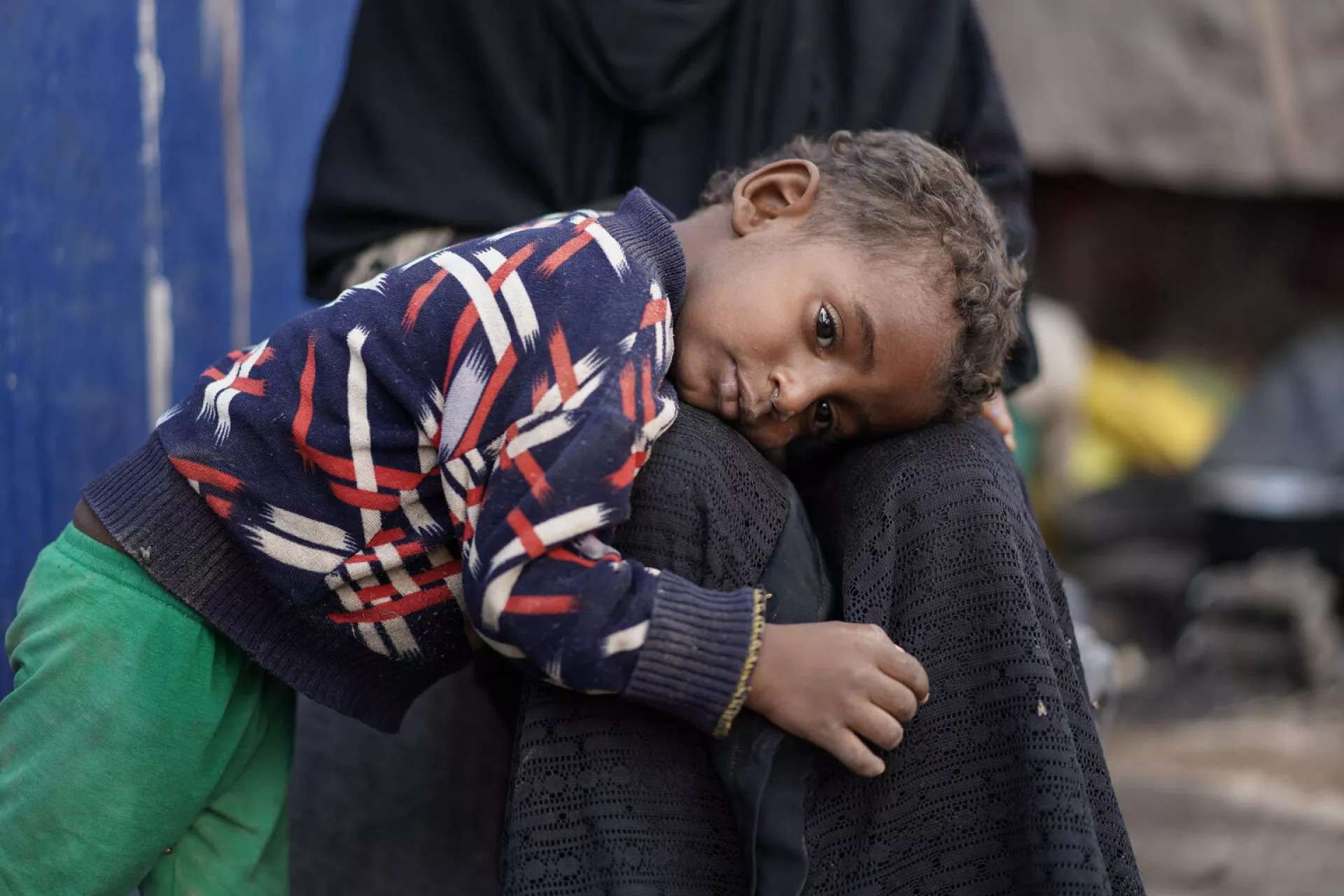 أرقام المنظمات الدولية لا تعكس حجم كارثة الأزمة الإنسانية في اليمن