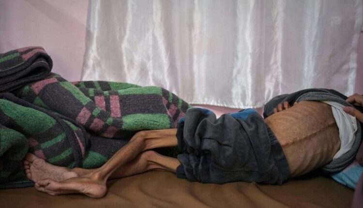 خطر المجاعة في غزة