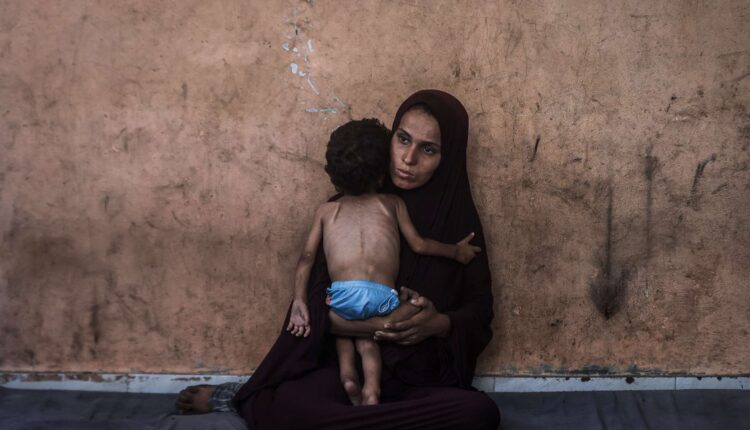 المجاعة في غزة